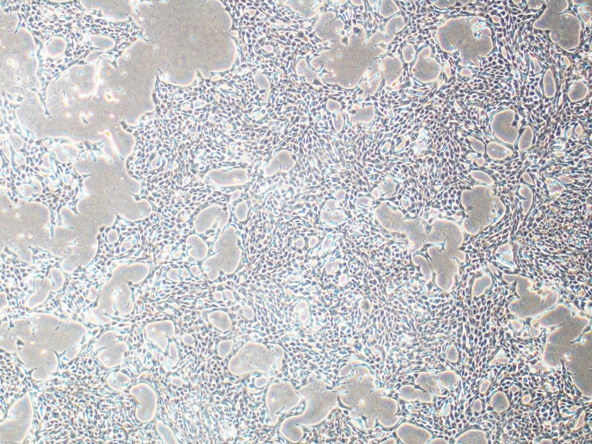 4T1 murine breast cancer cells. 